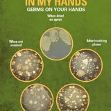 Images of germs on hands
