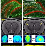 A sideb-by-side comparison showing scans of a normal brain with scans of a brain exposed to a nerve agent. The nerve-agent exposed brain shows signs of abnormalities.