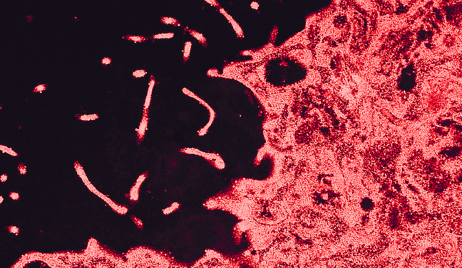 An electron microscope image of flu virus.