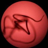 A mircroscopic image of the nematode that causes the disease elephantiasis