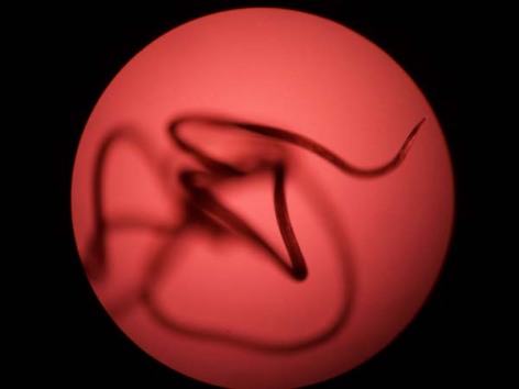 A mircroscopic image of the nematode that causes the disease elephantiasis