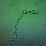 A microscope image of a schistosome, a parasitic worm