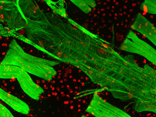 Magnified image of fly cardiac muscle