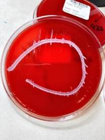 A bacterial culture grows inside a red-stained Petri dish