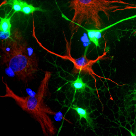 Neural stem cells viewed under a fluorescence microscope.