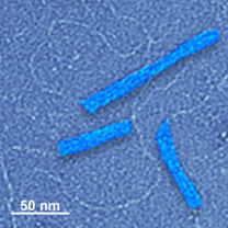 An electron microscope images shows two shorter blue structures and one longer one.
